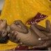 खाद्य सुरक्षा से संभव है कुपोषण पर काबू
