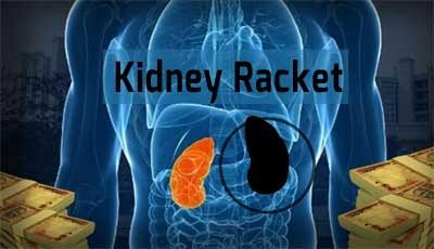 kidney-racket-2